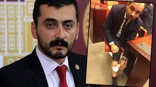 Eren Erdem'den çok sert 'bacak ısırma' açıklaması