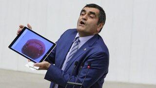 Meclis'te tartışma: Isırık izi böyle olmaz!