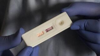 Yeni dönem başlıyor! HIV/AIDS eğitim müfredatına girecek