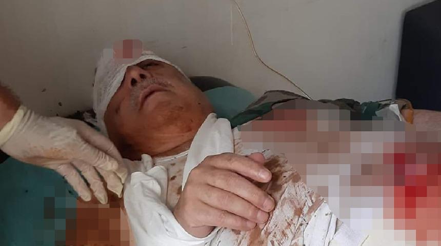 'Terörist Mihraç Ural, patlamada yaralandı' iddiası