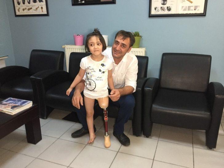 Minik Özge’nin yeni protez bacak mutluluğu G1