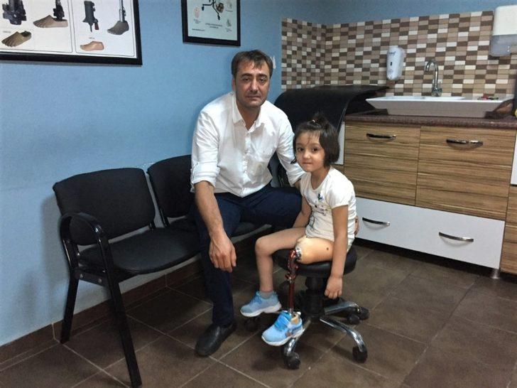 Minik Özge’nin yeni protez bacak mutluluğu G2