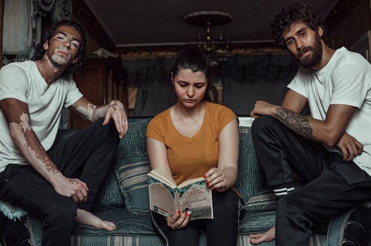 Winnie Harlow'dan sonra erkek vitiligo model! G5