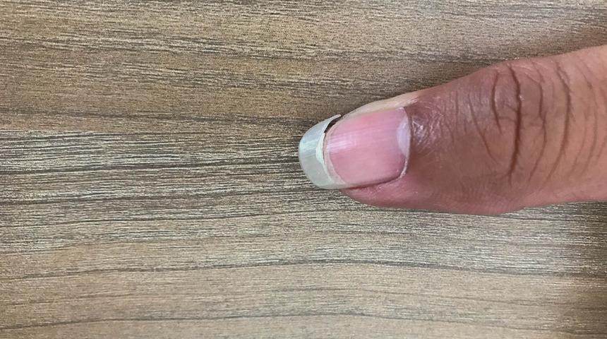 Beyaz lekeler, koyu çizgiler... Önemsenmiyor ama tırnaklar sağlığınız hakkında pek çok şey söylüyor