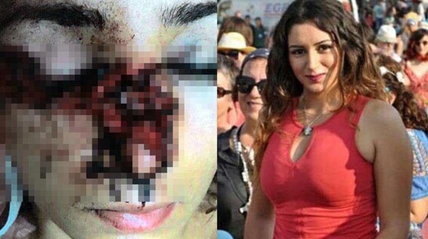 Dehşetin b&ouml;ylesi! Kamp yerinde ayrılmak istediğini s&ouml;yleyince hayatı kabusa d&ouml;nd&uuml;