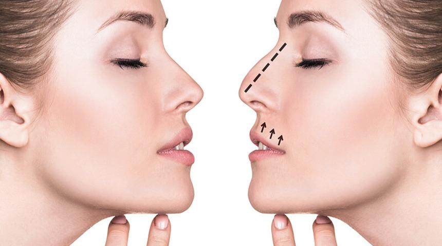 Cerrahların sanatı 3 boyutlu burun estetiği