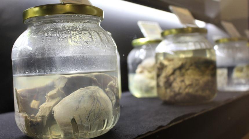 Bu müze çok farklı! Ceninler, iç organlar...