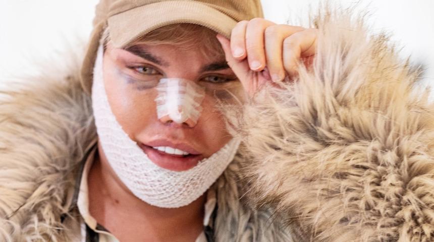 Defalarca bı&ccedil;ak altına yattı! Son g&ouml;r&uuml;nt&uuml;s&uuml; şaşırttı