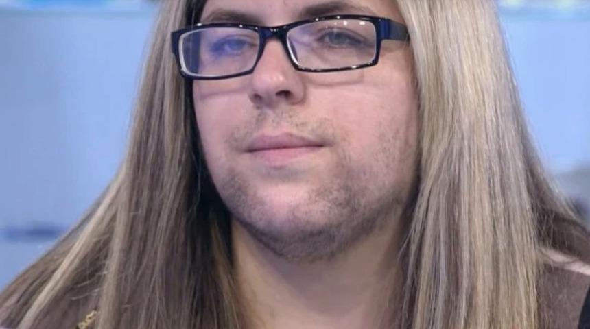 Doğumdan sonra sakalları çıkan talihsiz kadın: Kocam benden yıllarca tiksindi