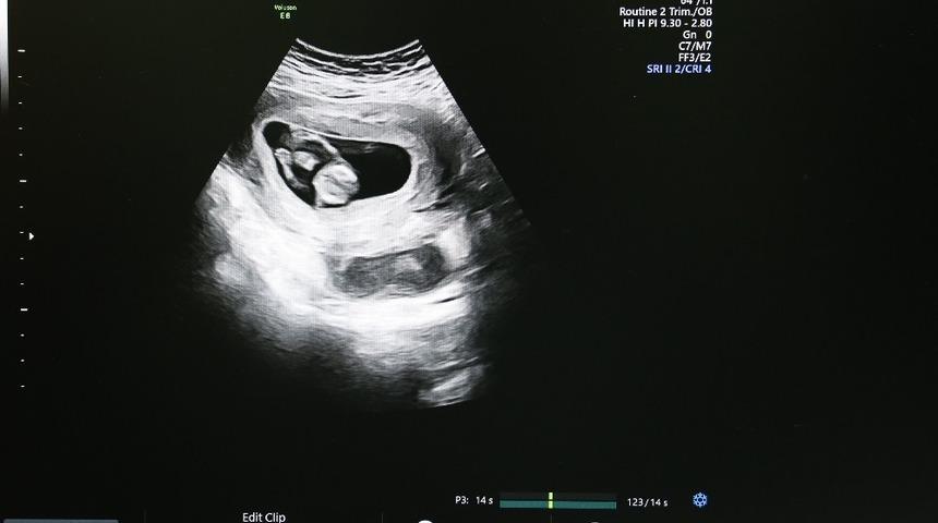 Riskli gebeliklerin takibi kolaylıkla yapılabilecek