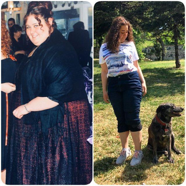 Değişimi inanılmaz! Ünlü isim 105 kilo birden verdi: İşte obezite ameliyatıyla zayıflayan ünlüler!