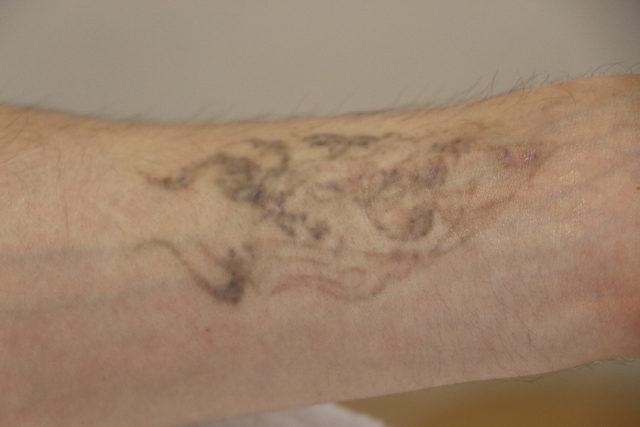 Polis ve asker olmak isteyenler, d&ouml;vme sildiriyor 2