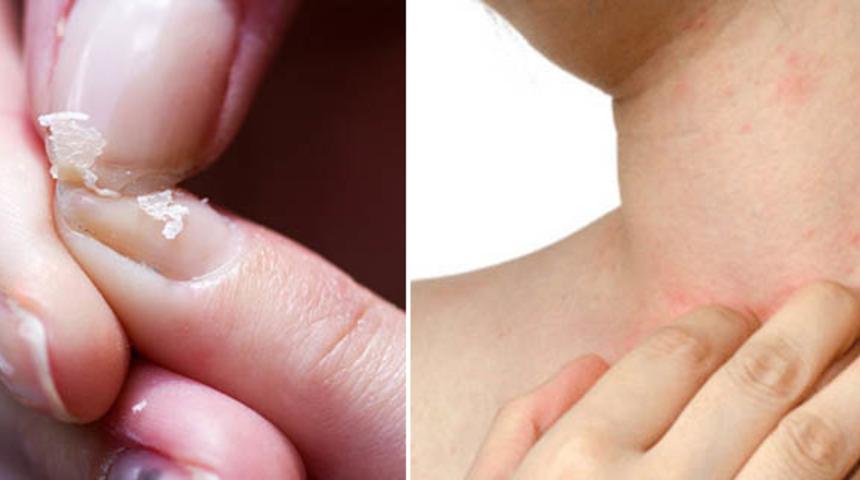 Hangi vitamin eksikliği hangi ciddi hastalıklara sebep oluyor?