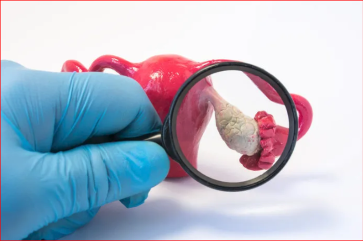 Her 4 kadından 1’inde adet düzensizliği görülüyor, bu sorunun altında ciddi nedenler yatıyor olabilir G3