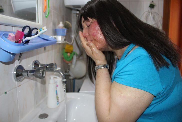 Her güneşe çıktığında DNA'sı mutasyona uğruyor! Yıllar sonra ilk kez... G1