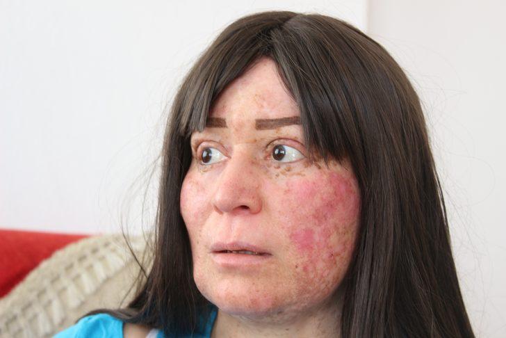 Her güneşe çıktığında DNA'sı mutasyona uğruyor! Yıllar sonra ilk kez... G4