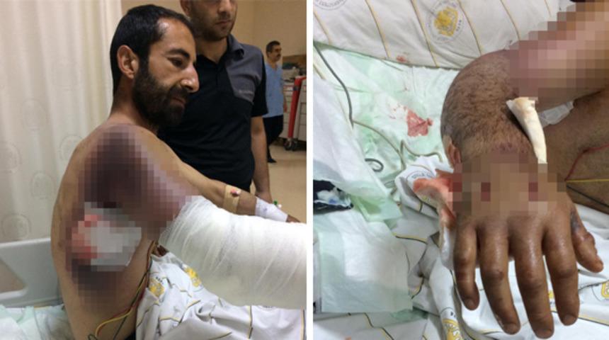 Diyarbakır'da korkunç olay! Taşla yaraladığı yılan ısırdı, hayati tehlikesi var