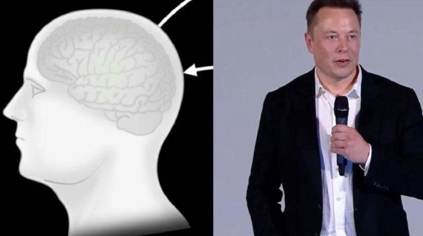 Elon Musk Neuralink deneyleri için kobay arıyor
