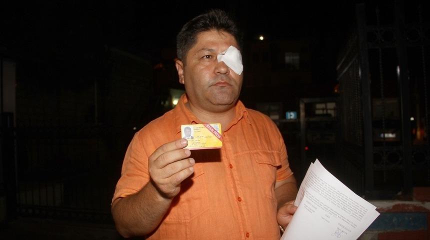 Fethiye’de gazeteciye saldırı