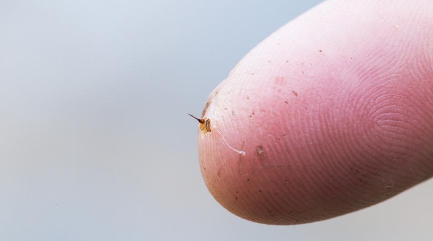 Arı sokmalarına her evde bulunan bu malzemeler &ccedil;&ouml;z&uuml;m olacak! 