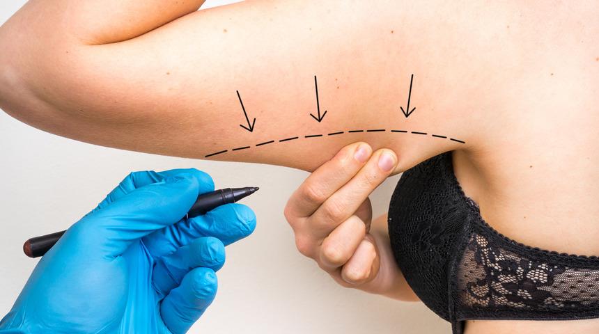 Kollarda oluşan sarkmalar nasıl düzeltilir?