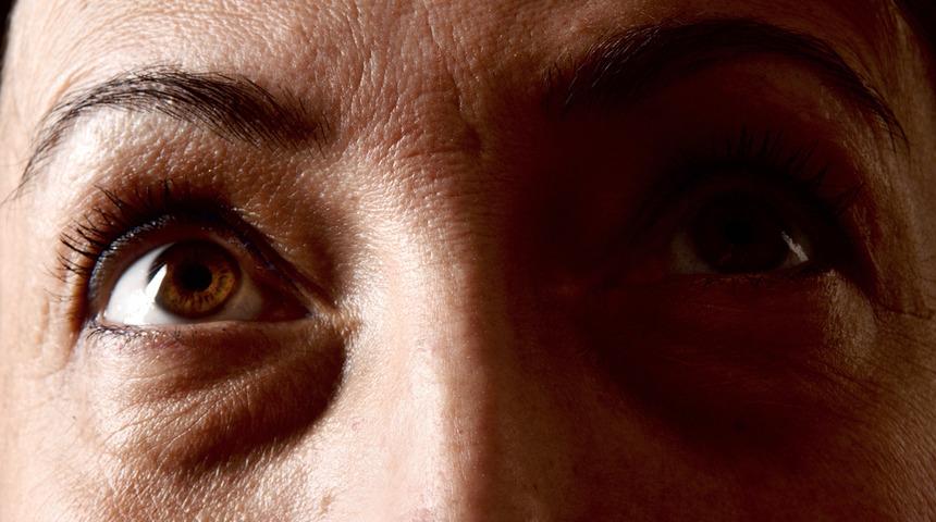 Göz altı torbaları neden olur?