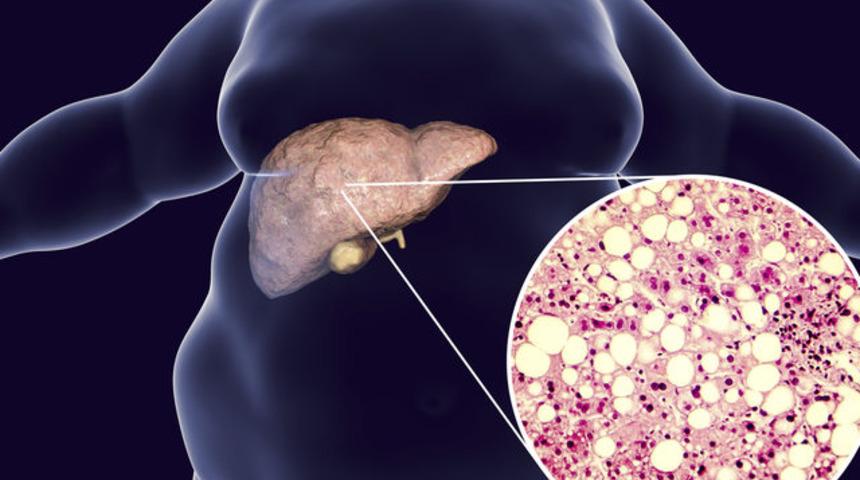 4 hafta boyunca alkol içmediğinizde vücudunuzda bakın neler oluyor
