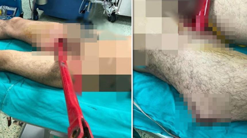 Korkunç kaza! Bacağına pulluk demiri saplandı