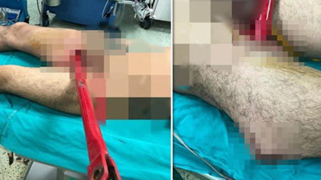 Korkunç kaza! Bacağına pulluk demiri saplandı