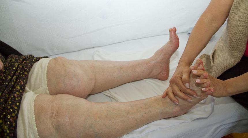 Kireçlenme kadınlarda daha çok görülüyor 