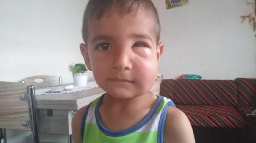 İki &ccedil;ocuğa arı saldırdı! K&ouml;yl&uuml;ler tarlaya gitmekten korkuyor