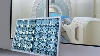 O diplomatlara gerçekten de bir şey olmuş!