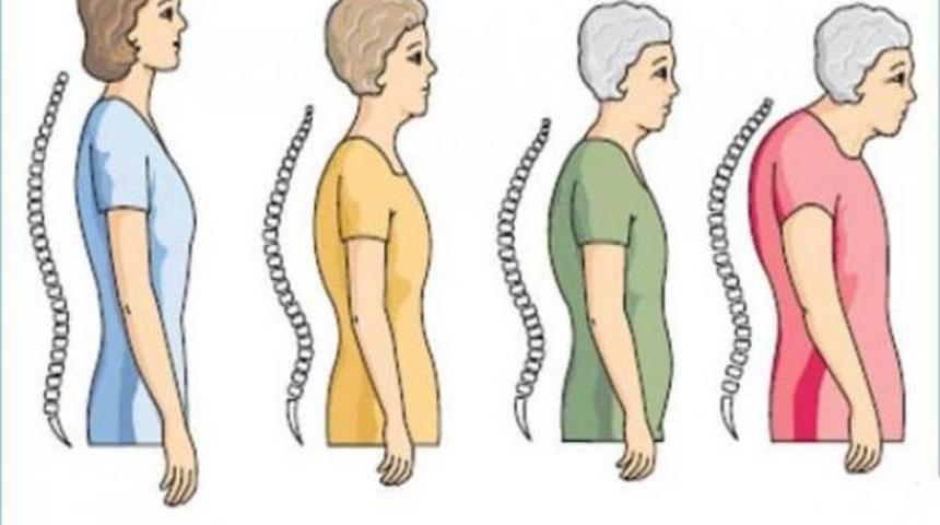 Kim Korkar Yaşlanmaktan: Kemik Erimesini &Ouml;nleyen Doğal K&uuml;r 