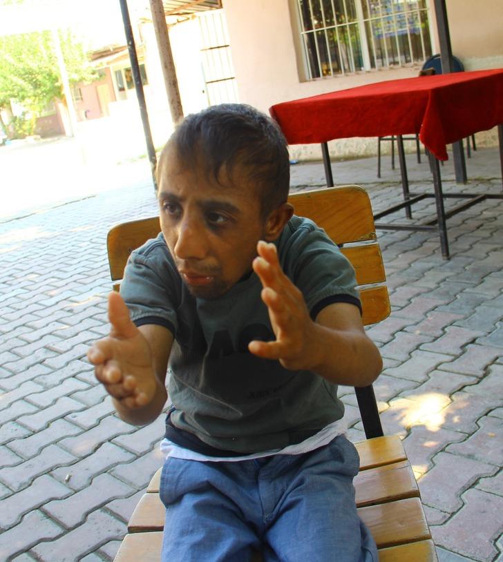 22 yılda sadece 11 kilo 400 grama ulaşabildi G5