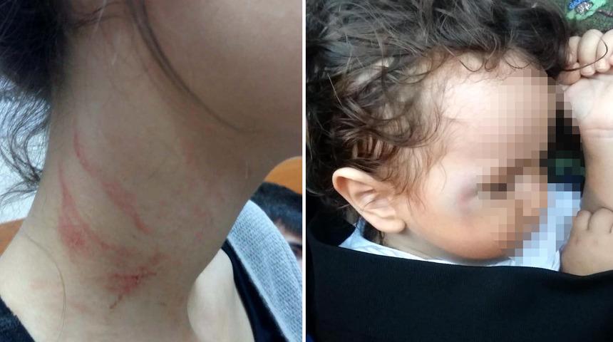 Kavga sırasında bebeğe de yumruk attılar!