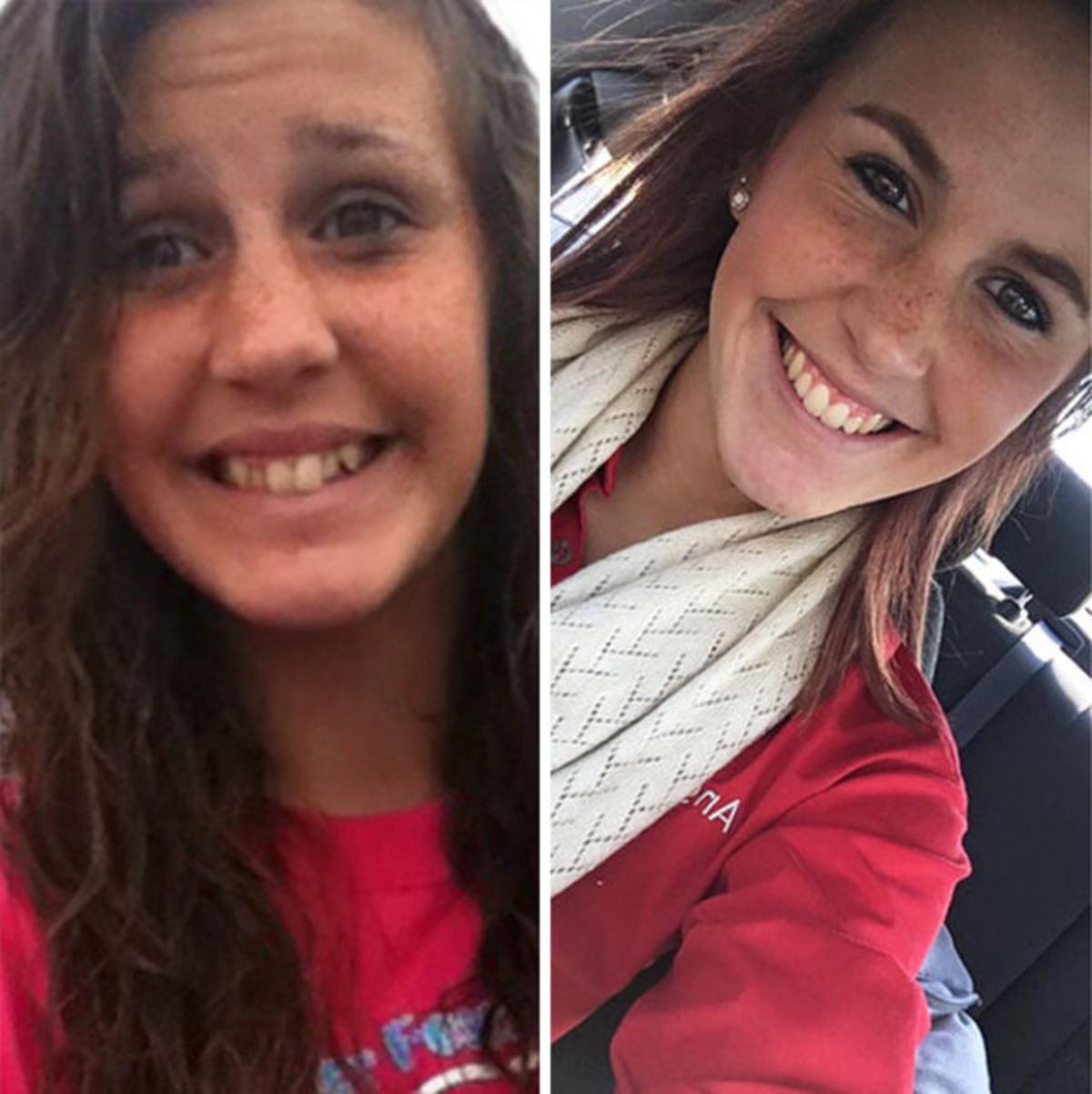 Ey diş teli sen nelere kadirsin! İnanılmaz değişim...