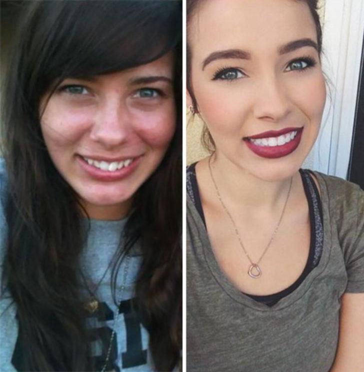 Ey diş teli sen nelere kadirsin! İnanılmaz değişim... G1