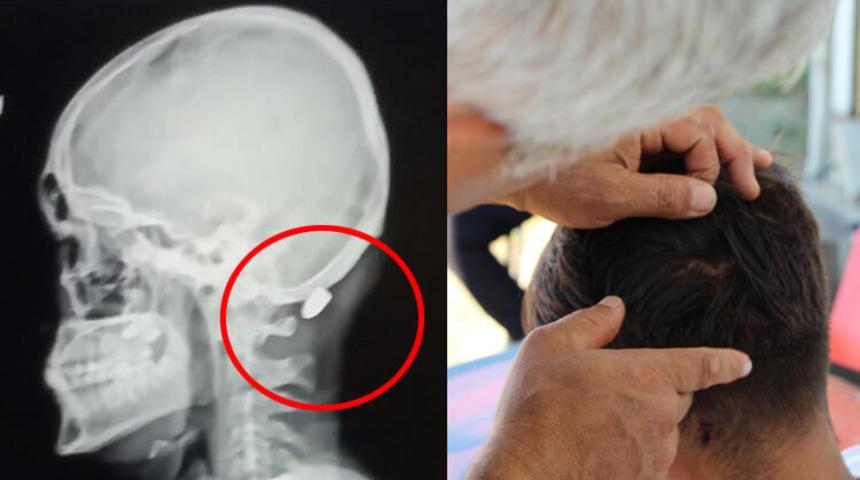 Trabzon'da maganda kurşunu! 1 cm ile kurtuldu