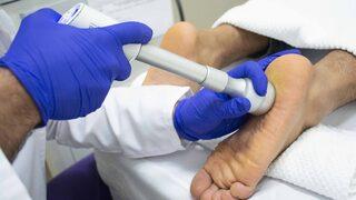 Topuk dikeni tedavisinde şok dalga uygulaması