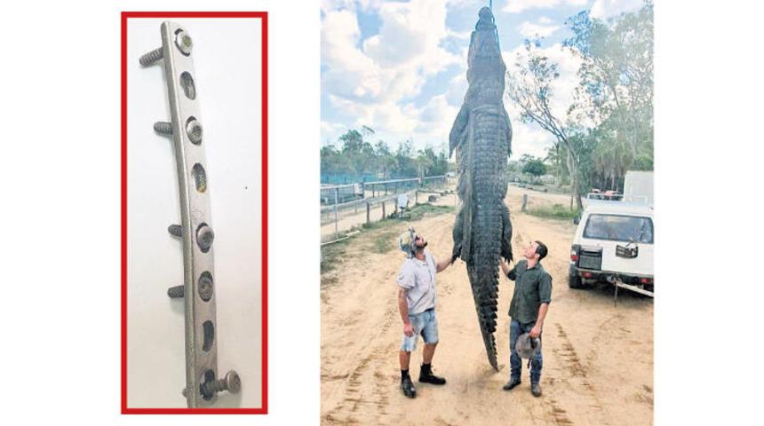 Timsah midesinden 8 vidalı plaka çıktı