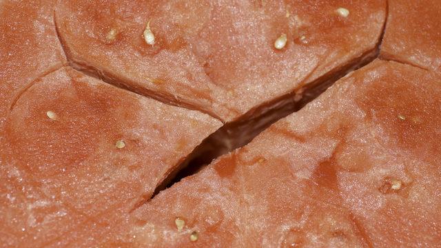 Hemoroidden karpuz ve şeftali ile korunun