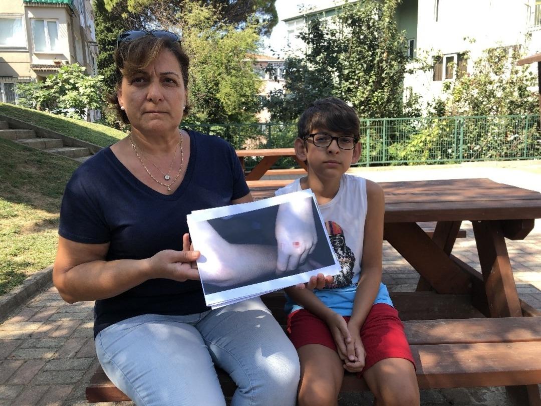 (&Ouml;zel) Beykoz&rsquo;da vatandaşlar k&ouml;pek saldırılarına karşı n&ouml;bette