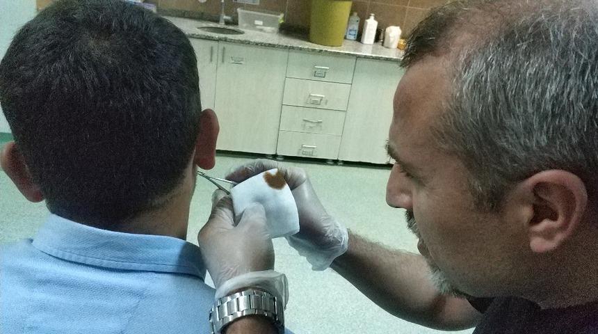 Kulağının arkasına kene tutundu