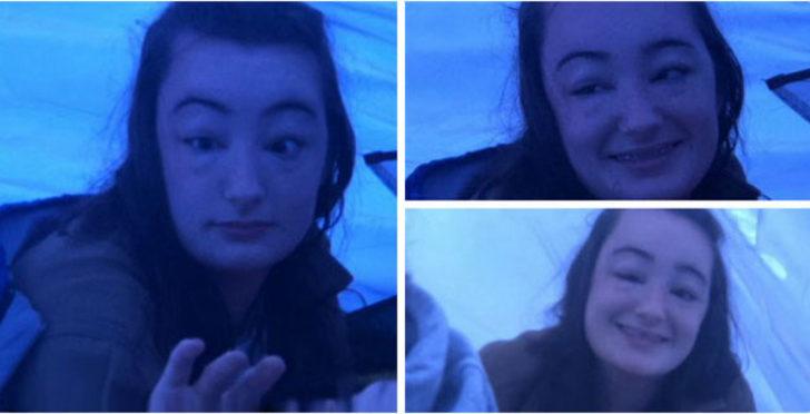 Yüzü bir anda şişmeye başladı ama o fotoğraf çekmeye devam etti! G3