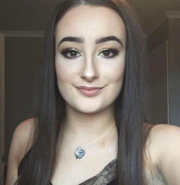 Yüzü bir anda şişmeye başladı ama o fotoğraf çekmeye devam etti! G4