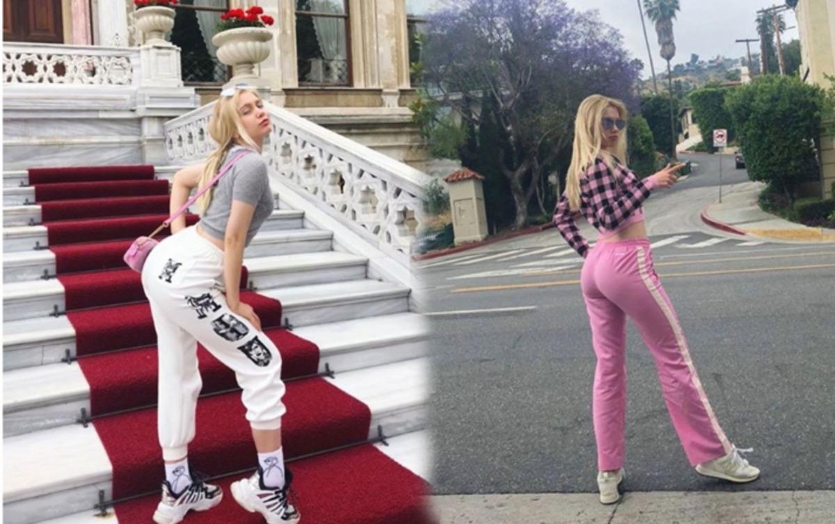 Aleyna Tilki'den estetik a&ccedil;ıklaması! Kal&ccedil;asına yağ enjekte ettirdi mi?