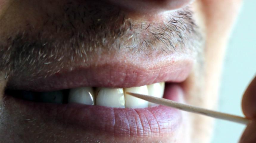 Samsun Dişhekimleri Odası Başkanı Alper Dilek'ten Kurban öncesi 'kürdan' uyarısı!