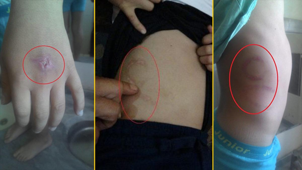 B&ouml;yle anne olmaz olsun! &Ouml;z oğlunun elini matkapla delip v&uuml;cudunu ısırdı