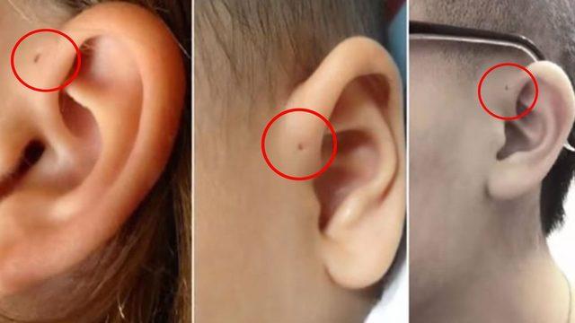 Bazı İnsanların Kulaklarında Bulunan Küçük Delik Ne Anlama Geliyor? 