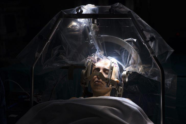 Parkinson hastasının beynine pil yerleştirildi G2